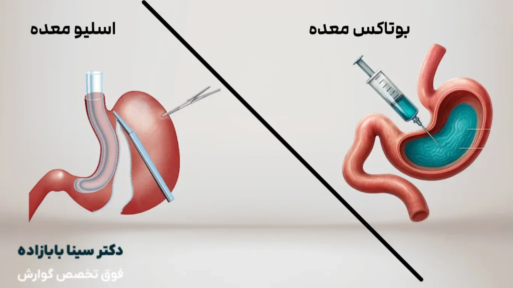 بوتاکس معده