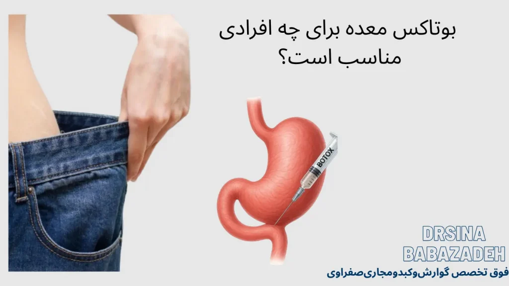 بوتاکس معده برای چه افرادی مناسب است؟