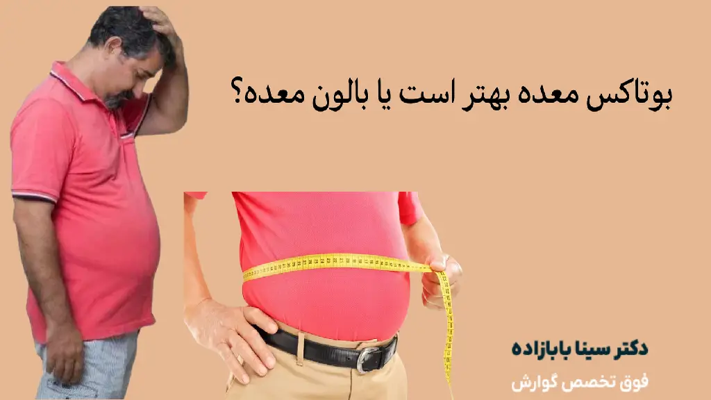 بوتاکس معده بهتر است یا بالون معده