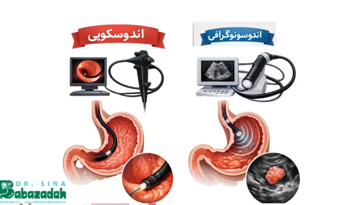 تفاوت های اندوسکوپی با اندوسونوگرافی