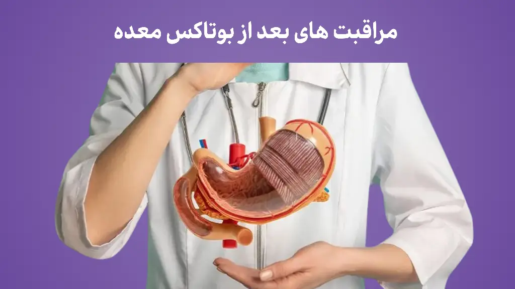 مراقبت های بعد از بوتاکس معده با دکتر سینا بابا زاده