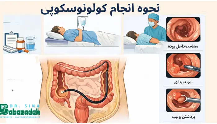 نحوه انجام کولونوسکوپبی