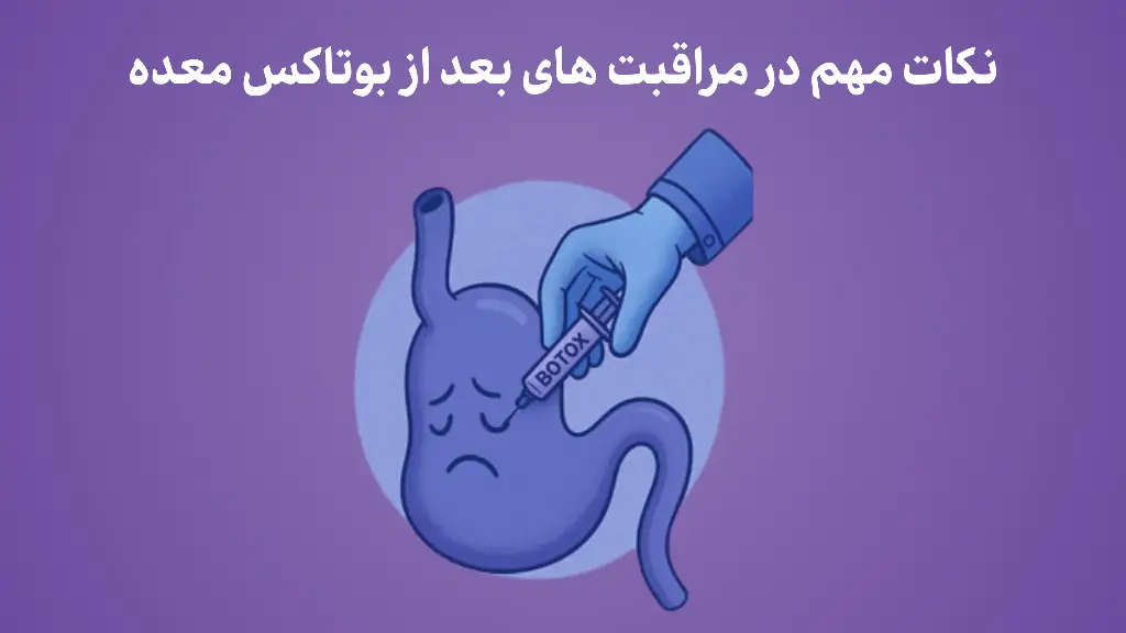نکات مهم در مراقبت های بعد از بوتاکس معده