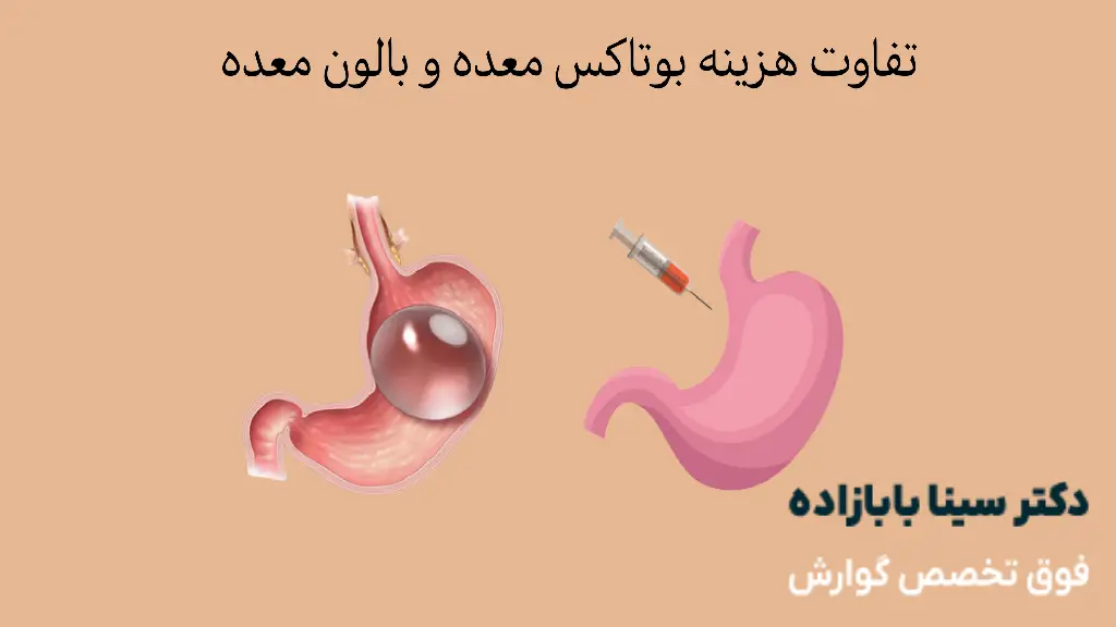 هزینه بوتاکس معده و بالون معده