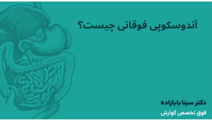 آندوسکوپی فوقانی