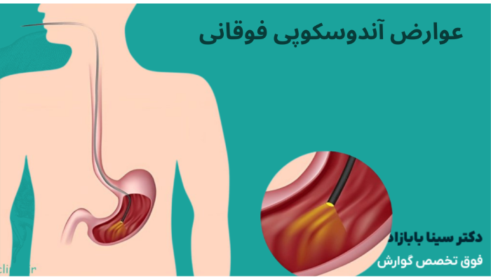 عوارض آندوسکوپی فوقانی