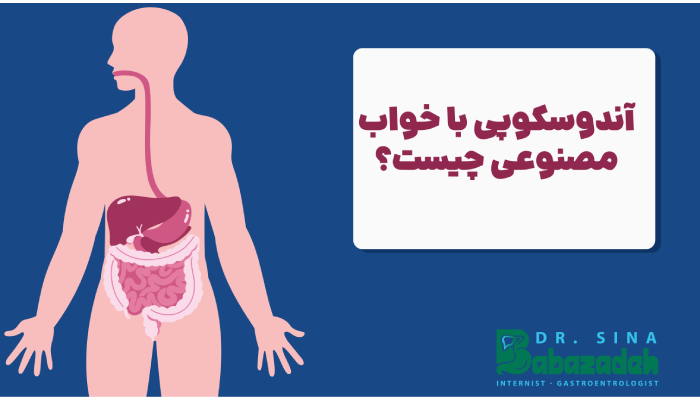 آندوسکوپی با خواب مصنوعی چیست؟