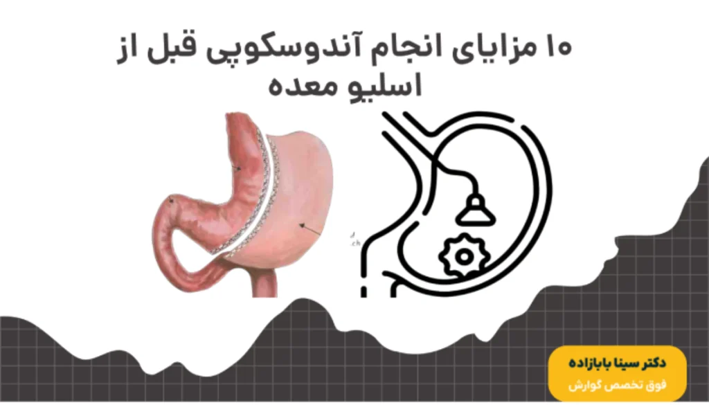 مزایای انجام آندوسکوپی قبل از اسلیو معده