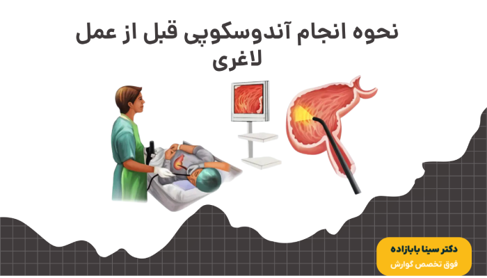 نحوه انجام آندوسکوپی قبل از عمل لاغری